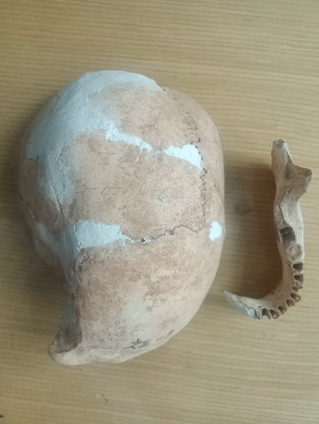 3호머리통뼈와 아래턱뼈 3호머리통뼈와 아래턱뼈